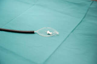 Linzer Ärzte fischten Pin-Nadel aus Lunge von 29-Jährigen pin-nadel_02.jpg